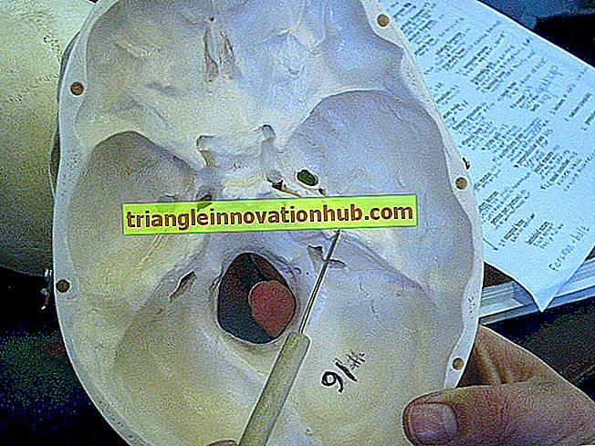 Ossa temporali: note utili sulle ossa temporali del cranio umano