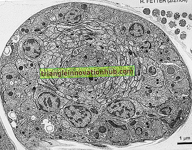 هيكل الكتروني مجهري لخلية بكتيرية نموذجية - مادة الاحياء