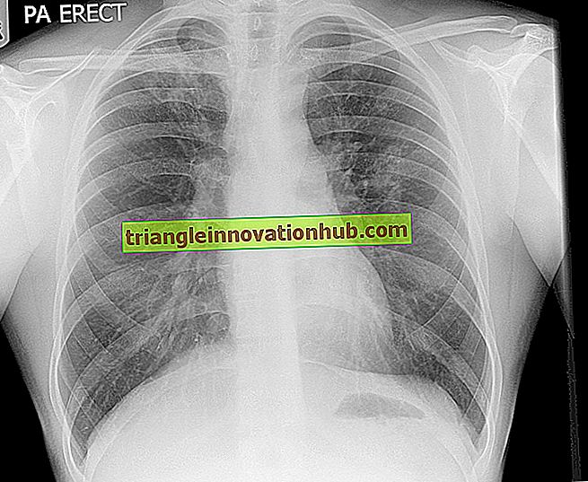 Hepatobiliary tuberculosis: En nära bild - sjukdomar