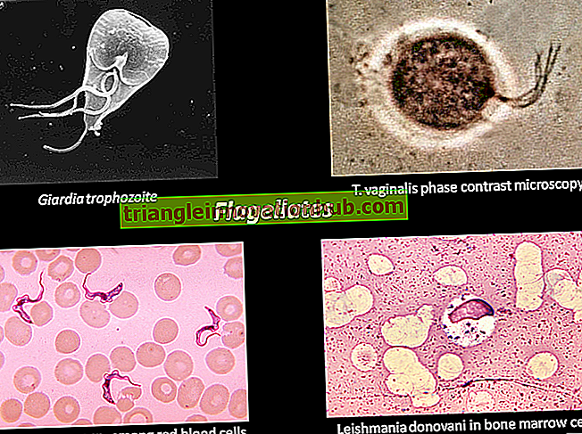 Parasit Trichomonas Vaginalis: Lebenszyklus, Infektionsart und Behandlung - Aufsatz