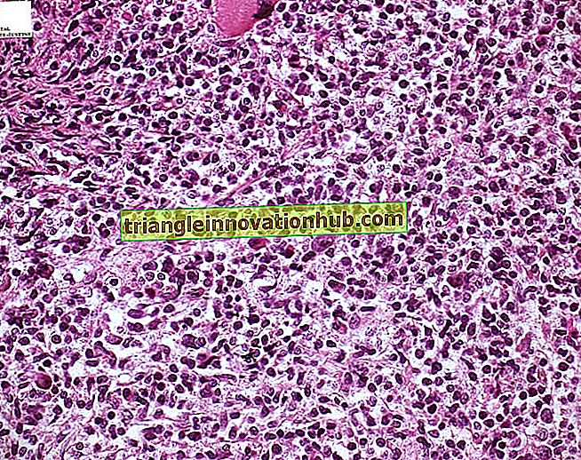 Thymus (T) -Lymphozyten aus menschlichem Knochenmark - erklärt (mit Abbildungen) - Immunologie
