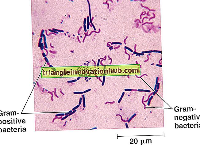 Esperimento per eseguire colorazione Gram dei batteri (con figura) - micro biologia